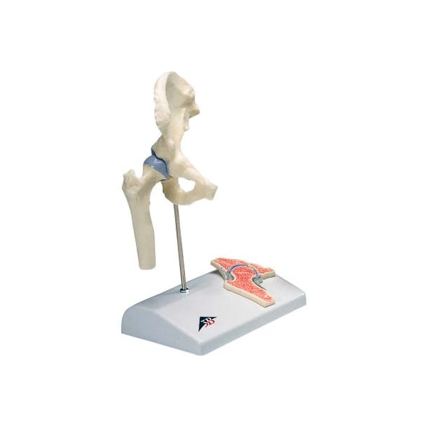 3B Anatomical Model - Mini Hip Joint with Cross Section of Bone on Base